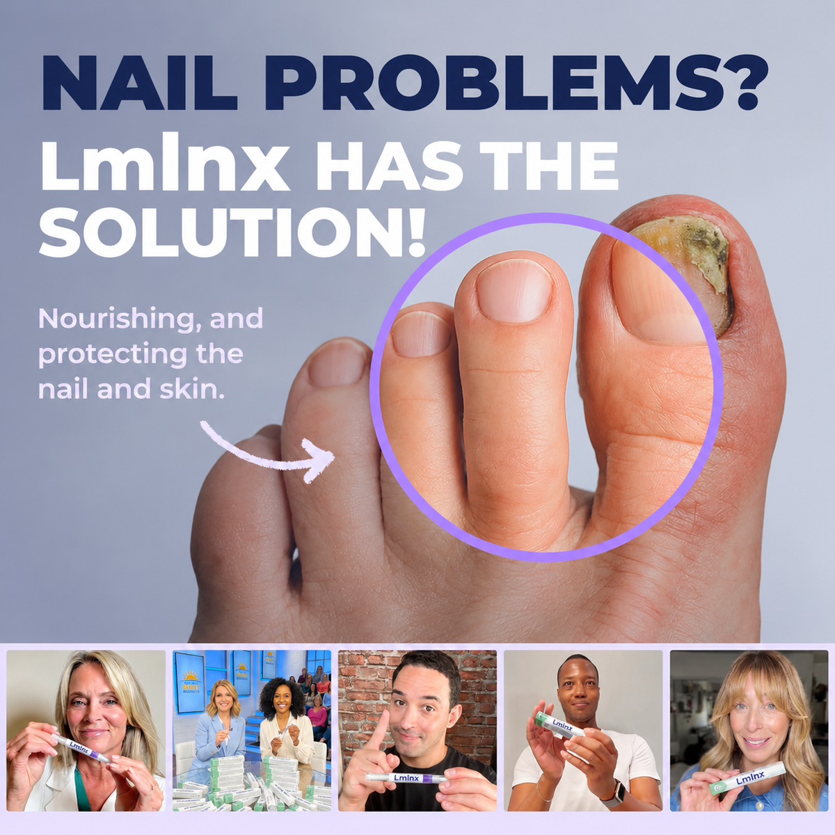 Lminx Nail Care Pen – A Natural Way to Eliminate Nail Fungus - For Good